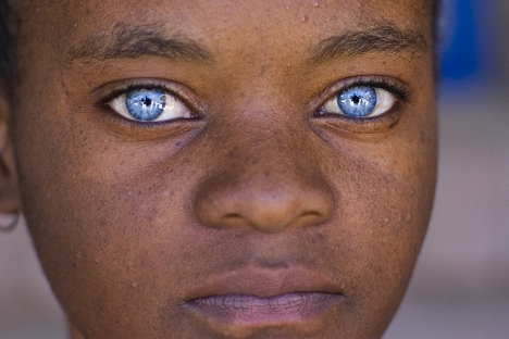 Black People with Blue Eyes: Natural Phenomenon or Genetic Mutation ...  width=